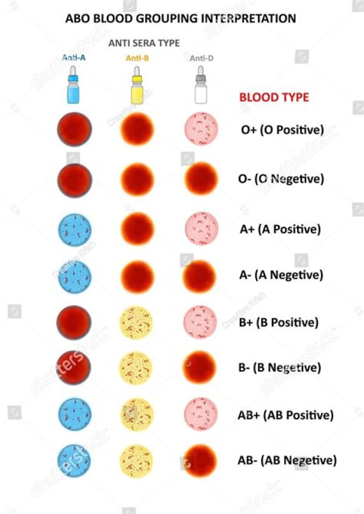 Are there any blood pack vendors other than Vandal?