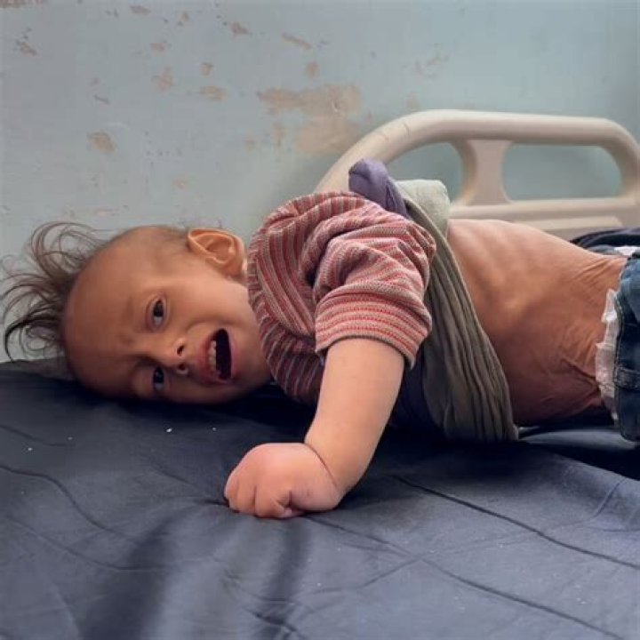 Can we starve to death?