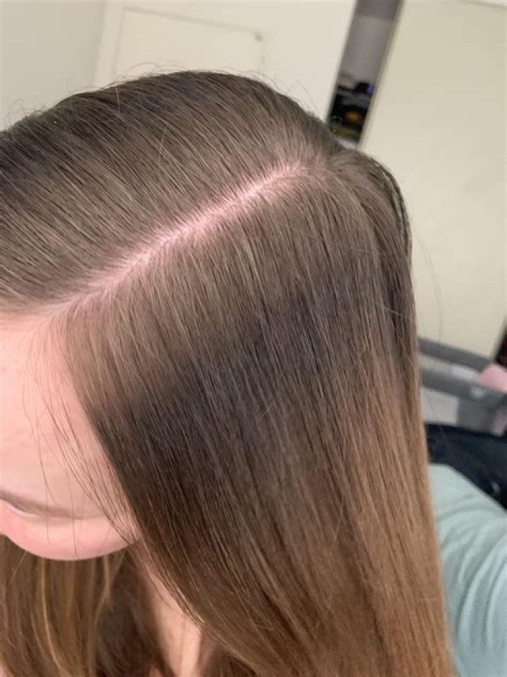 Why does Dan's hair change color?